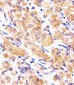 RPLP0P6 Antibody (N-term)